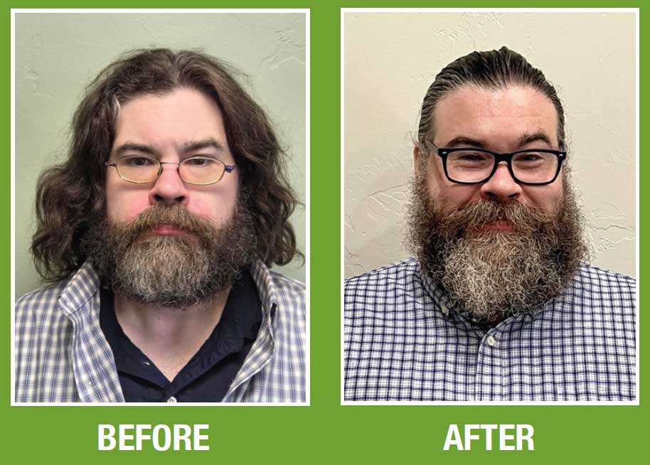 matthew before & after